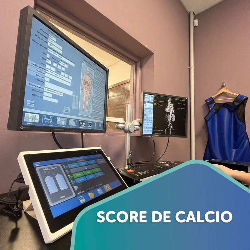 Consola del tomógrafo durante un score de calcio