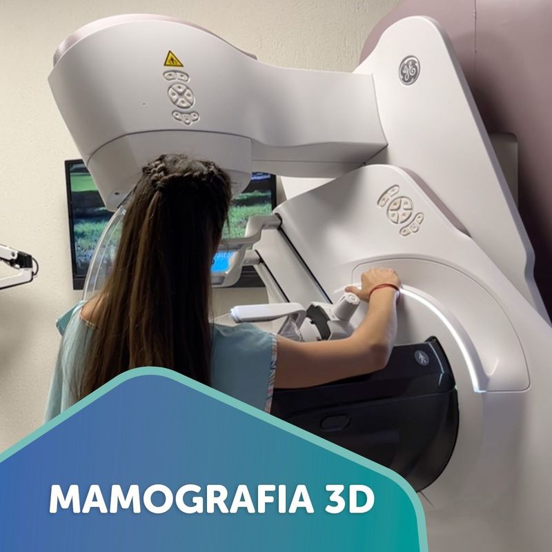 Paciente frente al mamógrafo 3D