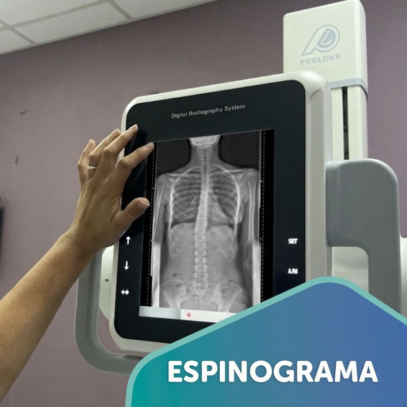 Pantalla del equipo digital con una radiografía de columna completa