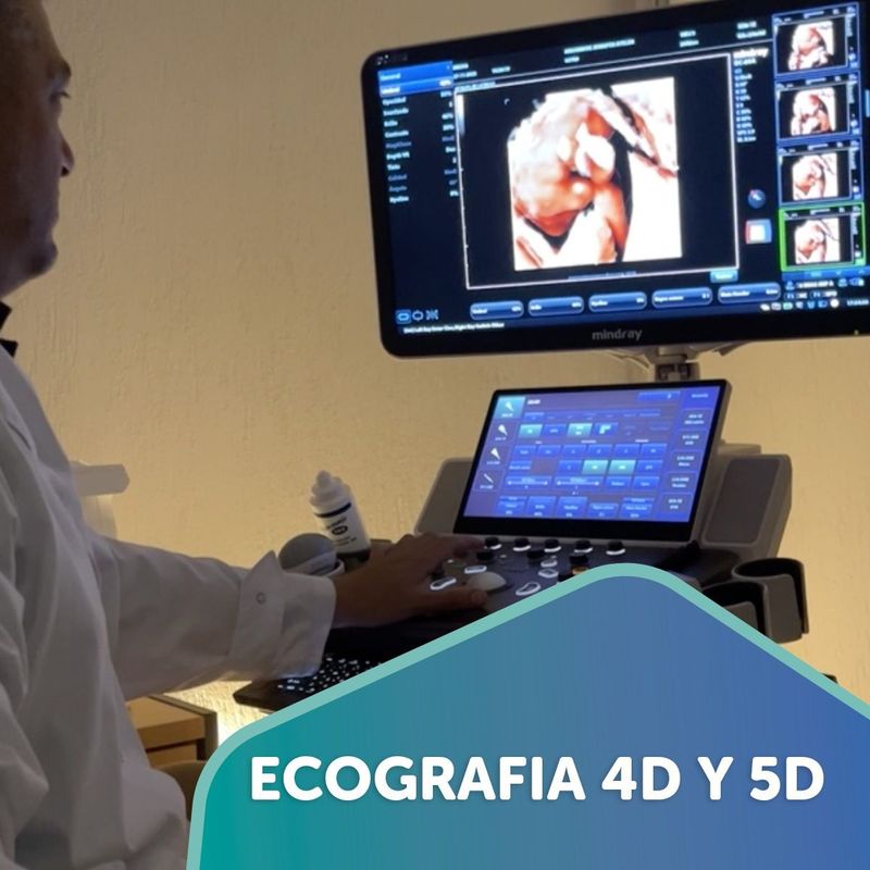 Ecógrafo mostrando la imagen de un bebé en 4D