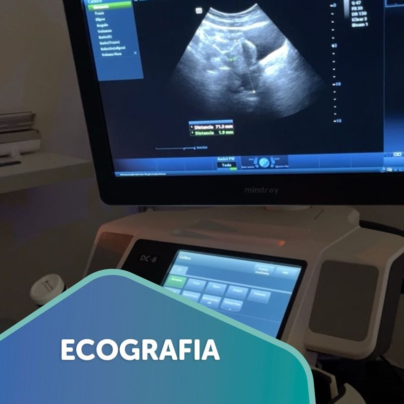 Ecógrafo mostrando una imagen en pantalla